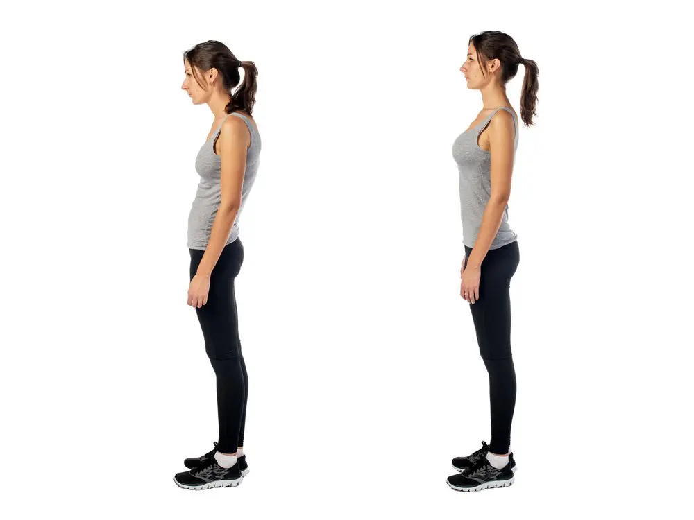 Chicago Scoliosis - Chiropractic Treatment Services of Scoliosis Conditions