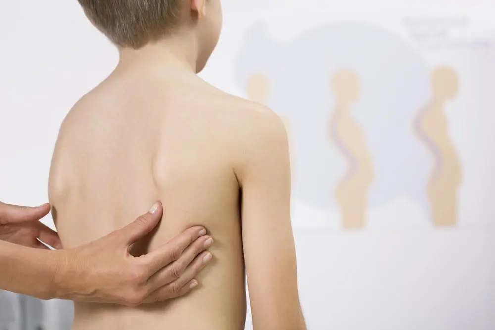Can Chiropractic Care Help the Treatment of Scoliosis in Chicago?