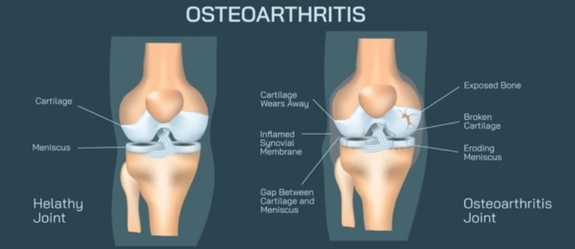 Knee Pain Chicago Treatment Holistic