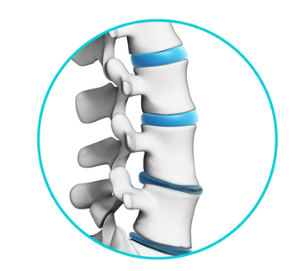 Lumbar Degenerative Disc Disease Treatments in Chicago IL - Advanced Spine & Sports Care